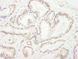 HP1 alpha Antibody, Novus Biologicals 0.1mL; Unlabeled:Antibodies, Polyclonal